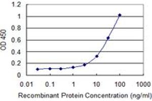 Detection limit for recombinant GST tagged EDC4 is 0. (EDC4 anticorps  (AA 1302-1401))