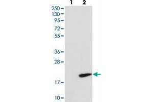Western blot analysis of Lane 1: Negative control (vector only transfected HEK293T lysate), Lane 2: Over-expression Lysate (Co-expressed with a C-terminal myc-DDK tag (~3. (RNF7 anticorps)