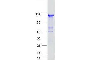 Validation with Western Blot