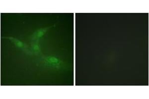 Immunofluorescence analysis of NIH-3T3 cells, using Breast Tumor Kinase (Phospho-Tyr447) Antibody. (PTK6 anticorps  (pTyr447))