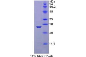 SDS-PAGE analysis of Rat Matrix Metalloproteinase 11 (MMP11) Protein.