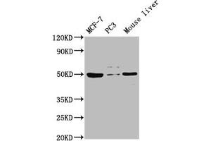 Western Blot Positive WB detected in: MCF-7 whole cell lysate, PC-3 whole cell lysate, Mouse liver tissue All lanes: PACSIN3 antibody at 1:2000 Secondary Goat polyclonal to rabbit IgG at 1/50000 dilution Predicted band size: 49 kDa Observed band size: 49 kDa