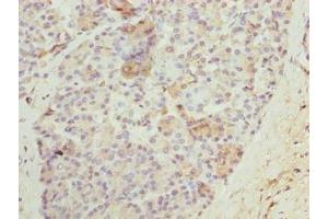 Immunohistochemistry of paraffin-embedded human pancreatic tissue using ABIN7161122 at dilution of 1:100