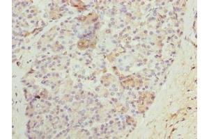 Immunohistochemistry of paraffin-embedded human pancreatic tissue using ABIN7161122 at dilution of 1:100 (N4BP2L2 anticorps  (AA 1-300))