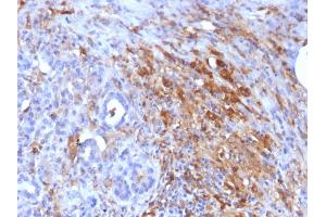 Formalin-fixed, paraffin-embedded Human Pancreas stained with Ferritin, Light Chain Mouse Monoclonal Antibody (FTL/1386).