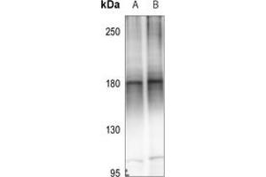 Western blot analysis of MEKK4 expression in A549 (A), EC9706 (B) whole cell lysates. (MAP3K4 anticorps  (C-Term))