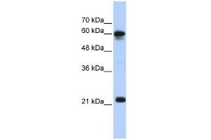 SEMA4F antibody used at 1 ug/ml to detect target protein. (SEMA4F anticorps  (N-Term))