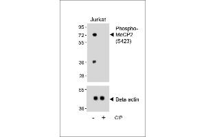 Western blot analysis of lysates from Jurkat cell line, untreated or treated with calf intestinal alkaline phosphatase(CIP), using Phospho-MeCP2 Antibody (upper) or Beta-actin (lower). (MECP2 anticorps  (pSer423))