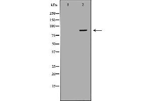 Western blot analysis of Hepg2 whole cell lysates, using CFB Antibody. (Complement Factor B anticorps  (Internal Region))