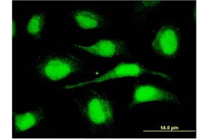 Immunofluorescence of monoclonal antibody to ORC6L on HeLa cell.