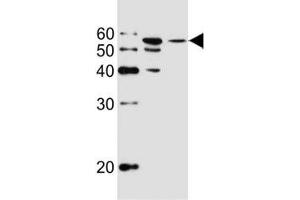Western blot analysis of lysate from MCF-7, T47D cell line (left to right) using ALDH6A1 antibody at 1:1000 for each lane. (ALDH6A1 anticorps)