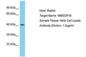 Image no. 1 for anti-Williams-Beuren Syndrome Chromosome Region 16 (WBSCR16) (AA 115-164) antibody (ABIN6750694) (WBSCR16 anticorps  (AA 115-164))