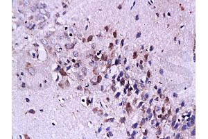 Formalin-fixed and paraffin embedded: rat brain tissue labeled with Anti-FasL Polyclonal Antibody, Unconjugated (ABIN726410) at 1:200, followed by conjugation to the secondary antibody and DAB staining (FASL anticorps  (AA 196-281))