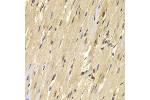 Immunohistochemistry of paraffin-embedded Mouse heart using TOPBP1 antibody at dilution of 1:100 (x40 lens). (TOPBP1 anticorps)