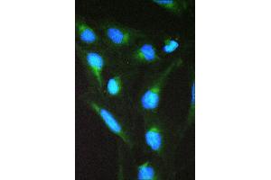 IF analysis of SPTLC1 using anti-SPTLC1 antibody (ABIN3044549).