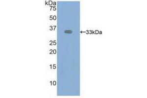 Western blot analysis of recombinant Human VEGFR2. (VEGFR2/CD309 anticorps  (AA 46-320))