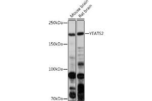 Western blot analysis of extracts of various cell lines, using YE antibody (ABIN7271413) at 1:1000 dilution.