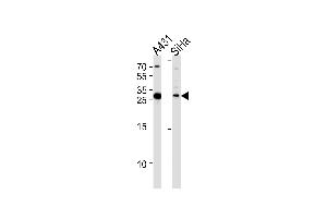Western blot analysis in A431,SiHa cell line lysates (35ug/lane). (HSD17B12 anticorps  (AA 126-155))