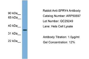 WB Suggested Anti-SPRY4  Antibody Titration: 0. (SPRY4 anticorps  (Middle Region))