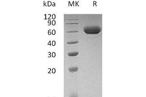 Western Blotting (WB) image for Lymphocyte-Activation Gene 3 (LAG3) (Active) protein (His tag) (ABIN7320610)
