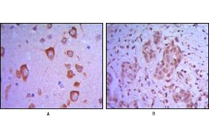 Immunohistochemical analysis of paraffin-embedded human brain tissue (A) and breast tumor (B) uing ETS1 mouse mAb. (ETS1 anticorps)