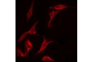 ABIN6269328 staining NIH-3T3 by IF/ICC. (PKC delta anticorps  (C-Term))