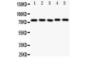 Anti-Tec antibody, Western blotting Lane 1: Rat Liver Tissue Lysate Lane 2: Rat Spleen Tissue Lysate Lane 3: Rat Kidney Tissue Lysate Lane 4: HELA Cell Lysate Lane 5: JURKAT Cell Lysate