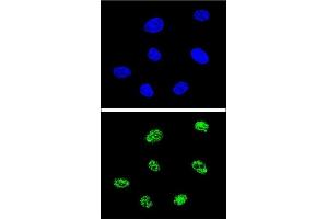 Confocal immunofluorescent analysis of TP73 Antibody (Center) (ABIN652829 and ABIN2842541) with 293 cell followed by Alexa Fluor® 488-conjugated goat anti-rabbit lgG (green). (Tumor Protein p73 anticorps  (AA 288-317))