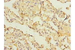 Immunohistochemistry of paraffin-embedded human lung tissue using ABIN7143477 at dilution of 1:100