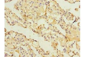 Immunohistochemistry of paraffin-embedded human lung tissue using ABIN7143477 at dilution of 1:100 (ARL11 anticorps  (AA 2-196))