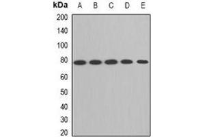 Western blot analysis of ACAS2 expression in HepG2 (A), SW620 (B), mouse liver (C), mouse kidney (D), rat brain (E) whole cell lysates.