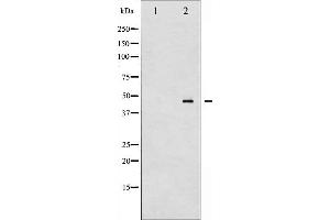 Western blot analysis of MEK2 phosphorylation expression in ovary cancer whole cell lysates,The lane on the left is treated with the antigen-specific peptide. (MEK2 anticorps  (pThr394))