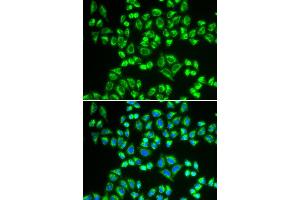 Immunofluorescence analysis of HeLa cell using SHMT2 antibody. (SHMT2 anticorps)