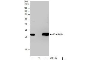 IP Image Immunoprecipitation of Prohibitin protein from 293T whole cell extracts using 5 μg of Prohibitin antibody, Western blot analysis was performed using Prohibitin antibody, EasyBlot anti-Rabbit IgG  was used as a secondary reagent. (Prohibitin anticorps)