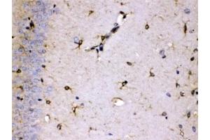 IHC testing of FFPE rat brain with ALDH7A1 antibody at 1ug/ml.