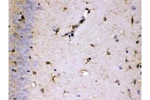 IHC testing of FFPE rat brain with ALDH7A1 antibody at 1ug/ml. (ALDH7A1 anticorps  (AA 333-369))