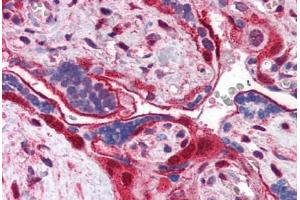 Human Placenta (formalin-fixed, paraffin-embedded) stained with ANXA11 antibody ABIN351460 at 3. (Annexin A11 anticorps  (AA 8-20))
