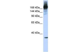 PRPF8 antibody used at 1 ug/ml to detect target protein. (PRPF8 anticorps)