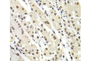 Immunohistochemistry of paraffin-embedded Human stomach using SOX5 Polyclonal Antibody at dilution of 1:100 (40x lens).