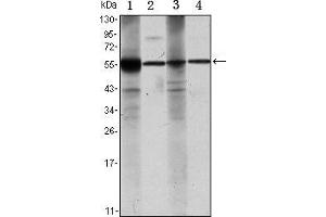 Western blot analysis using ALDH1A1 mouse mAb against Raji (1), Jurkat (2), THP-1 (3) and K562 (4) cell lysate. (ALDH1A1 anticorps)