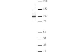 NFkB p100 pAb tested by Western blot. (NFKB2 anticorps  (C-Term))