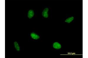 Immunofluorescence of purified MaxPab antibody to RAD51AP1 on HeLa cell. (RAD51AP1 anticorps  (AA 1-335))