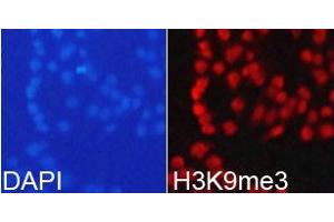 anti-Histone antibody