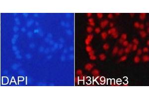 Immunofluorescence analysis of 293T cell using H3K9me3antibody. (Histone 3 anticorps  (H3K9me3))