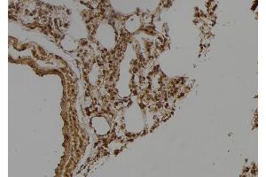 ABIN6275649 at 1/100 staining Rat lung tissue by IHC-P.