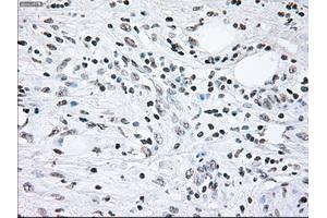 Image no. 17 for anti-B-Raf proto-oncogene, serine/threonine kinase (BRAF) antibody (ABIN1496961)