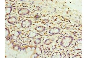 Immunohistochemistry of paraffin-embedded human small intestine tissue using ABIN7152050 at dilution of 1:100 (SULT1E1 anticorps  (AA 140-294))