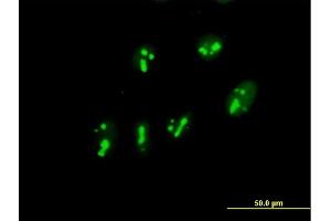 Immunofluorescence of purified MaxPab antibody to PARN on HeLa cell. (PARN anticorps  (AA 1-639))