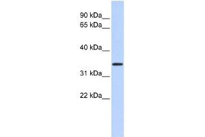 WB Suggested Anti-CCDC90A Antibody Titration:  0. (CCDC90A anticorps  (Middle Region))