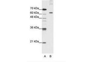 Image no. 2 for anti-Pumilio RNA Binding Family Member 3 (PUM3) (AA 61-110) antibody (ABIN203236) (KIAA0020 anticorps  (AA 61-110))
